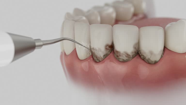 Trusted Wisdom Tooth Removal service in Elim, PA - Dentist Open Now